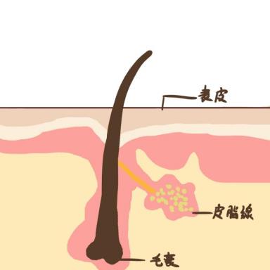 甲硝唑凝胶作用和用法是什么？看这篇你就知道了