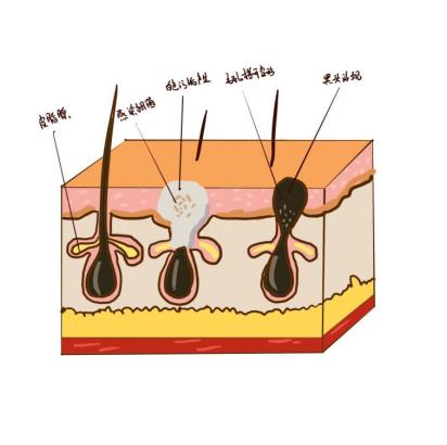 黑头是怎么产生的？原来是这样