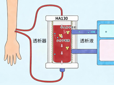 血液灌流适应什么症状？尿毒症患者出现这些情况可以考虑