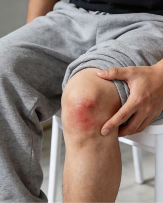 一文了解腿扭伤筋了怎么快速恢复？