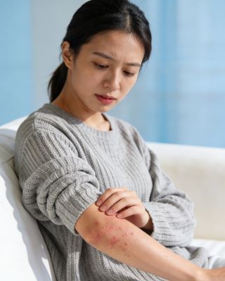 伤科灵喷雾剂治湿疹效果如何？