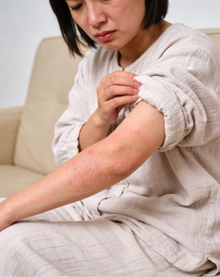 湿疹用什么牌子药好？