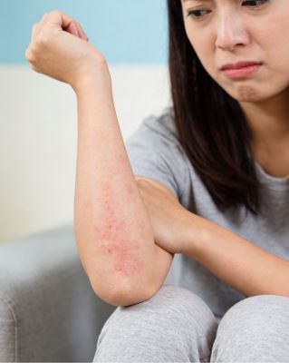 伤科灵治湿疹好吗？